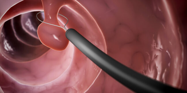 Ambulatorio endoscopico – 2