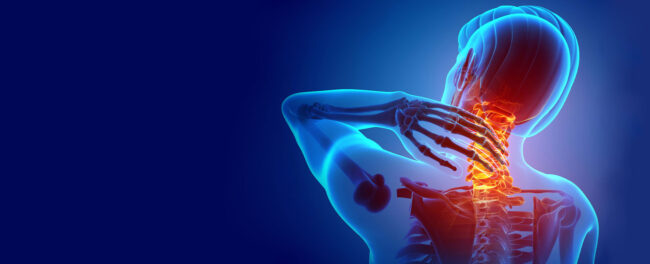 Risonanza magnetica cervicale slider